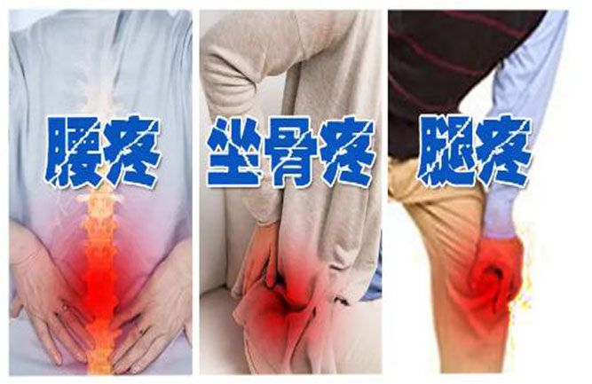 腰椎間盤突出坐姿、睡姿、日常鍛煉、最好治療方法